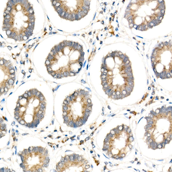 HEXA Rabbit monoclonal antibody