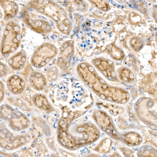HEXA Rabbit monoclonal antibody