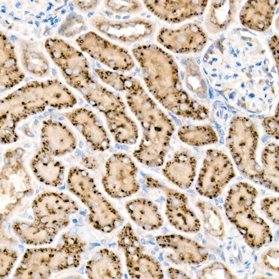 HEXA Rabbit monoclonal antibody