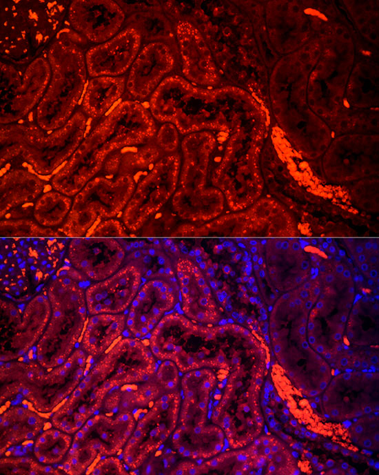 HEXA Rabbit monoclonal antibody