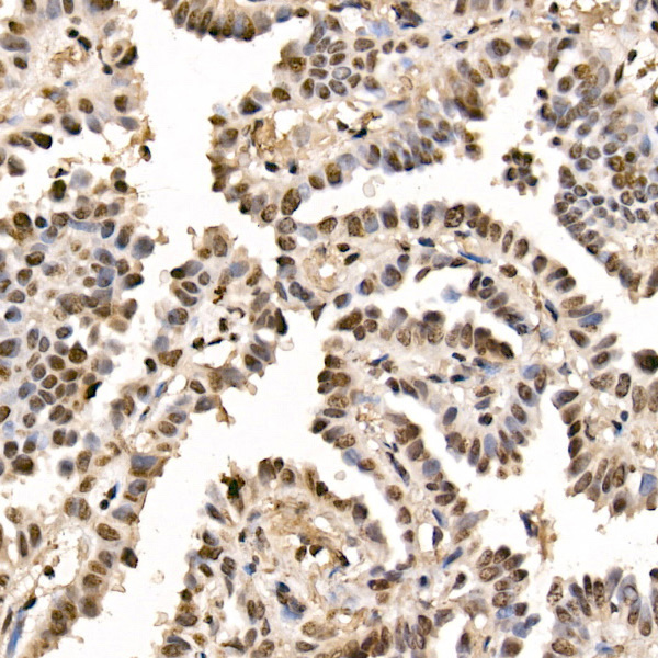 GLI2 Rabbit monoclonal antibody