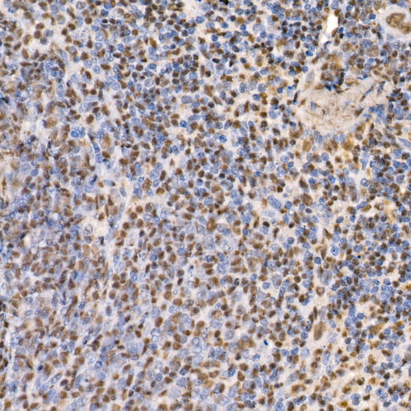 GLI2 Rabbit monoclonal antibody