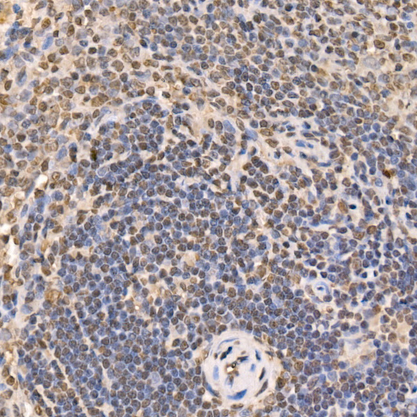 GLI2 Rabbit monoclonal antibody