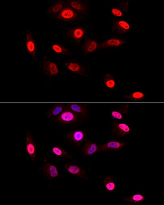 GLI2 Rabbit monoclonal antibody