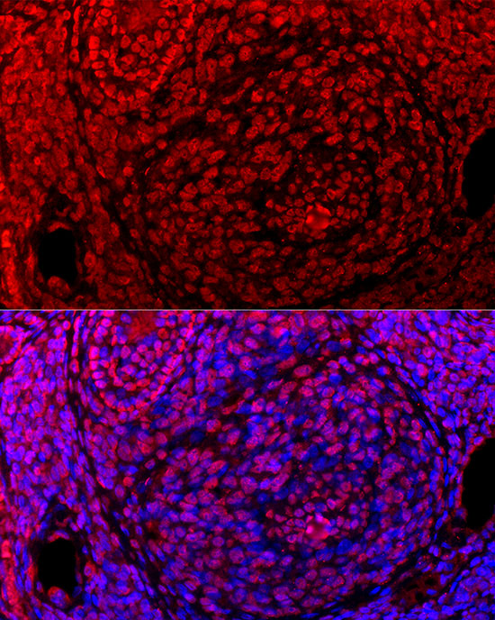 GLI2 Rabbit monoclonal antibody
