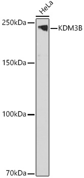 KDM3B Rabbit polyclonal antibody