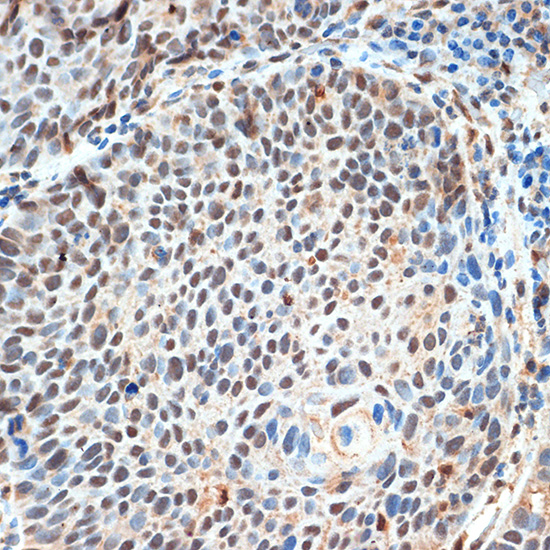 KDM3B Rabbit polyclonal antibody