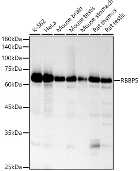 RBBP5 Rabbit monoclonal antibody