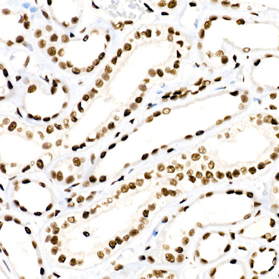 RBBP5 Rabbit monoclonal antibody