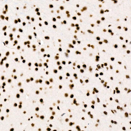 RBBP5 Rabbit monoclonal antibody