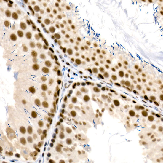 RBBP5 Rabbit monoclonal antibody