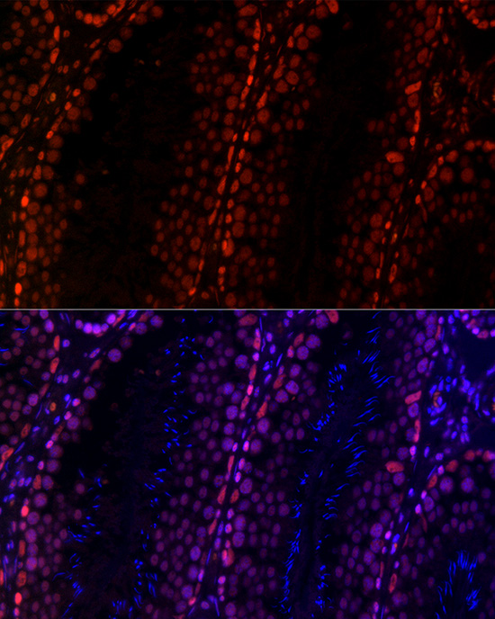 RBBP5 Rabbit monoclonal antibody