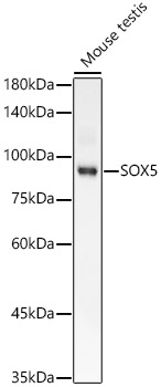 SOX5 Rabbit monoclonal antibody