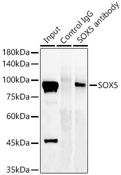 SOX5 Rabbit monoclonal antibody