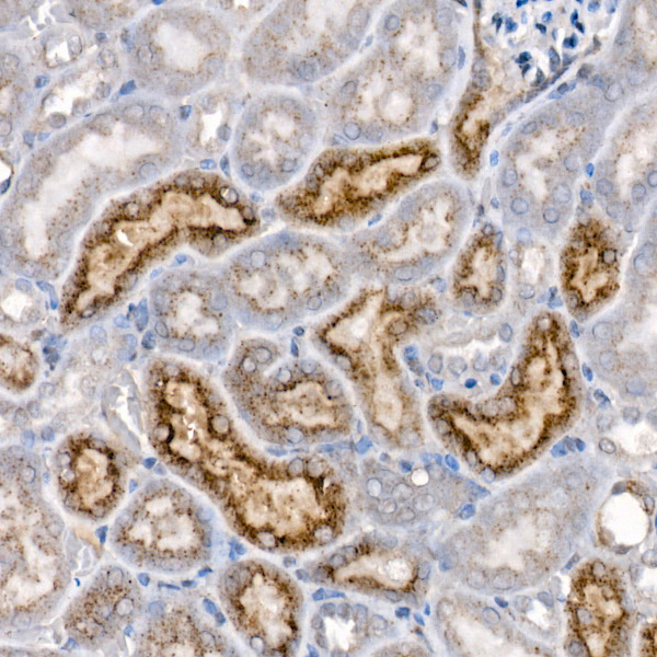 Niemann-Pick type C2 (NPC2) Rabbit monoclonal antibody
