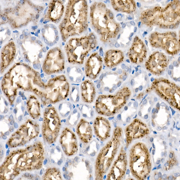 Niemann-Pick type C2 (NPC2) Rabbit monoclonal antibody