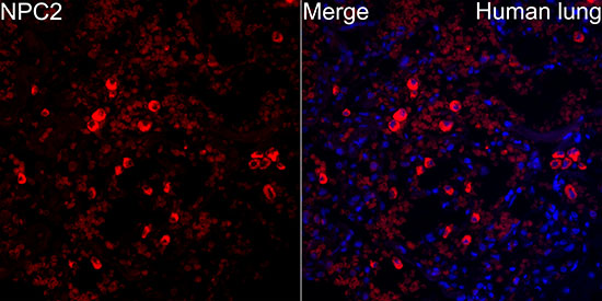 Niemann-Pick type C2 (NPC2) Rabbit monoclonal antibody