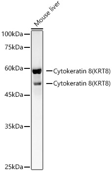 Cytokeratin 8 Rabbit monoclonal antibody