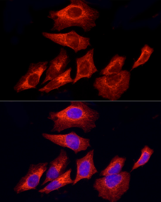Cytokeratin 8 Rabbit monoclonal antibody