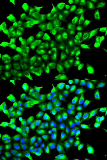 PHD2/EGLN1 Rabbit pAb