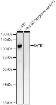 SATB1 Rabbit monoclonal antibody