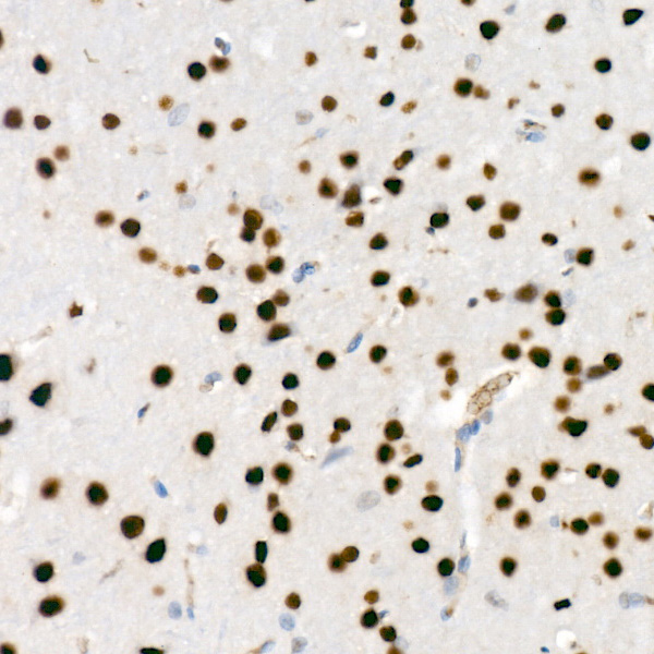 SATB1 Rabbit monoclonal antibody