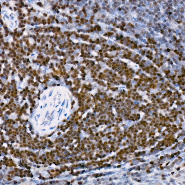SATB1 Rabbit monoclonal antibody