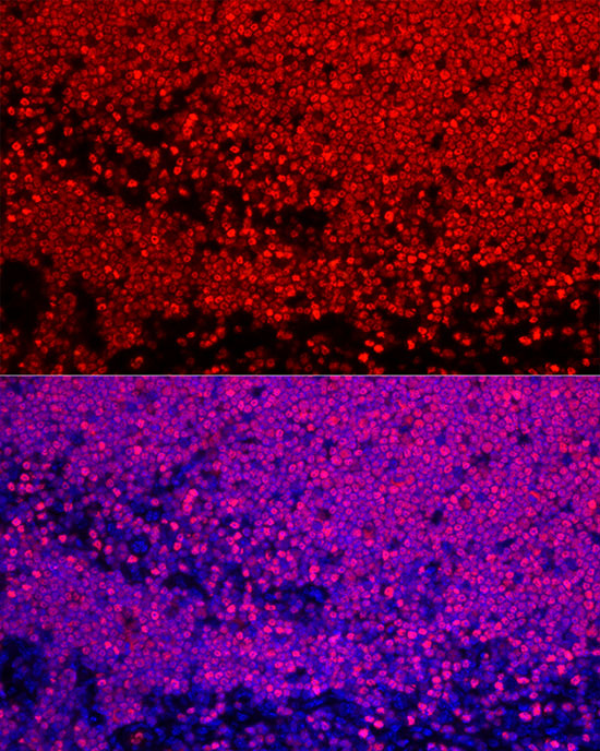 SATB1 Rabbit monoclonal antibody