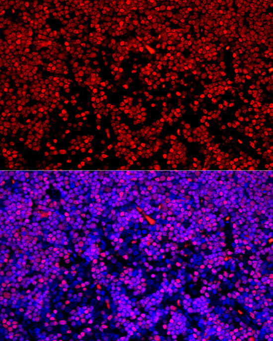 SATB1 Rabbit monoclonal antibody