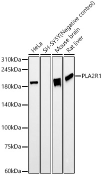 PLA2R1 Rabbit monoclonal antibody
