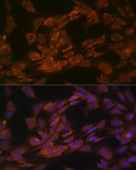 Nogo Rabbit monoclonal antibody
