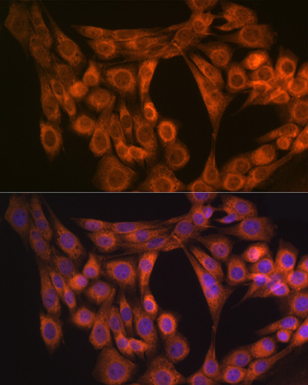 Nogo Rabbit monoclonal antibody