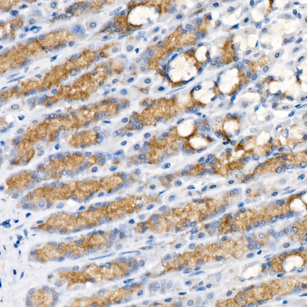 Pepsinogen I (PG I) Rabbit monoclonal antibody