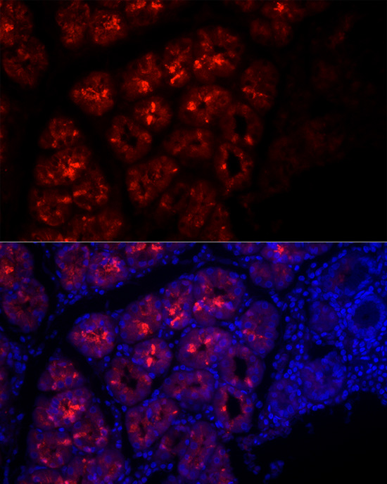 Pepsinogen I (PG I) Rabbit monoclonal antibody