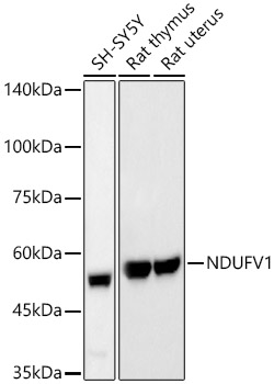 NDUFV1 Rabbit monoclonal antibody