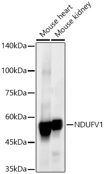 NDUFV1 Rabbit monoclonal antibody