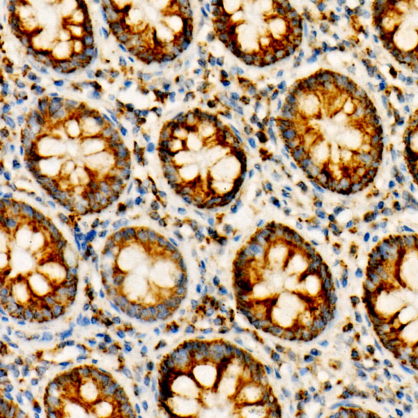 NDUFV1 Rabbit monoclonal antibody