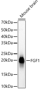 FGF1 Rabbit monoclonal antibody