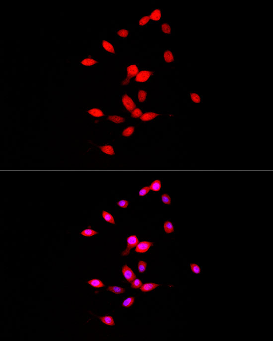 FGF1 Rabbit monoclonal antibody