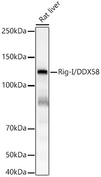 Rig-I/DDX58 Rabbit mAb