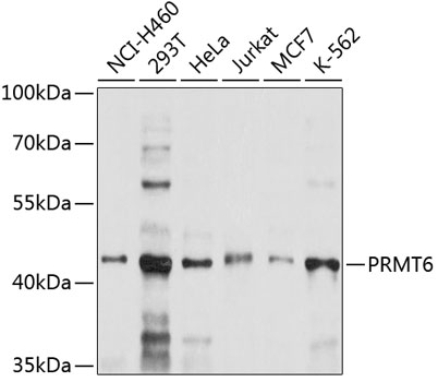 PRMT6 Rabbit polyclonal antibody