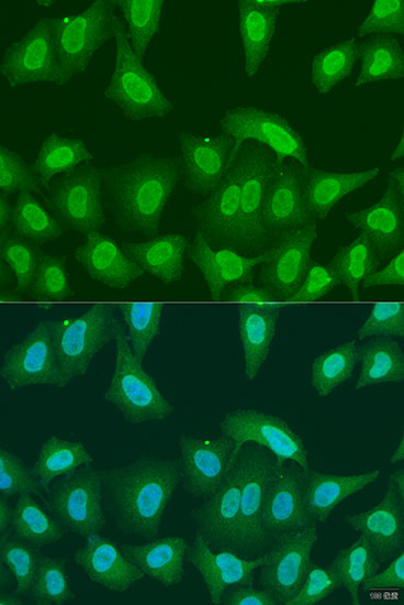 PRMT6 Rabbit polyclonal antibody
