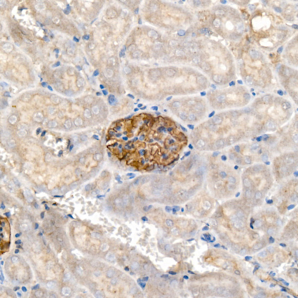 Nephrin Rabbit monoclonal antibody