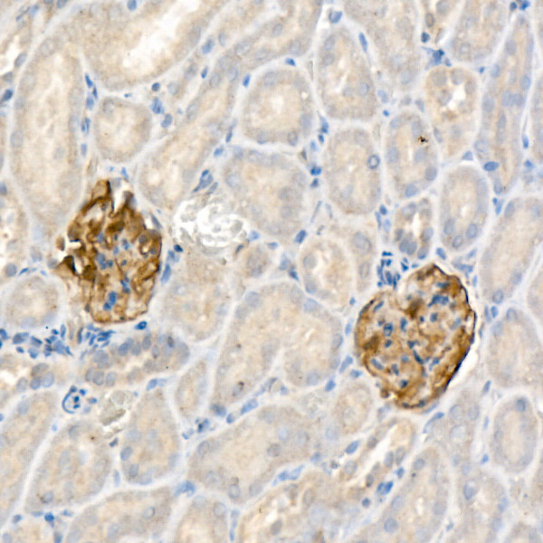 Nephrin Rabbit monoclonal antibody