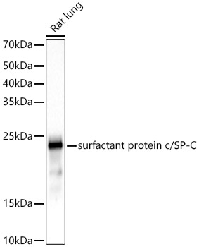 SFTPC Rabbit monoclonal antibody
