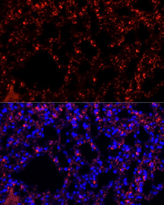 SFTPC Rabbit monoclonal antibody