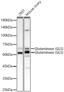 Glutaminase (GLS) Rabbit monoclonal antibody
