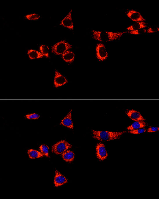 Glutaminase (GLS) Rabbit monoclonal antibody