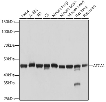 A Alpha-Actin-1 (ACTA1) Rabbit monoclonal antibody