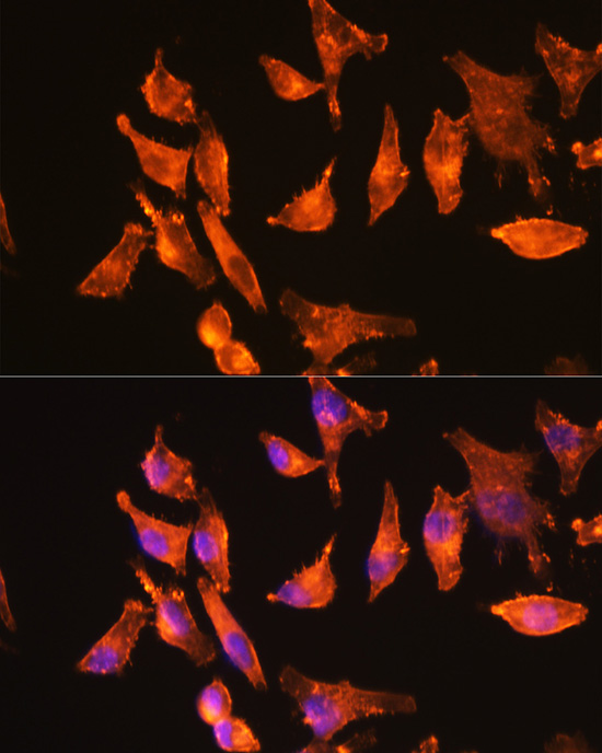 A Alpha-Actin-1 (ACTA1) Rabbit monoclonal antibody